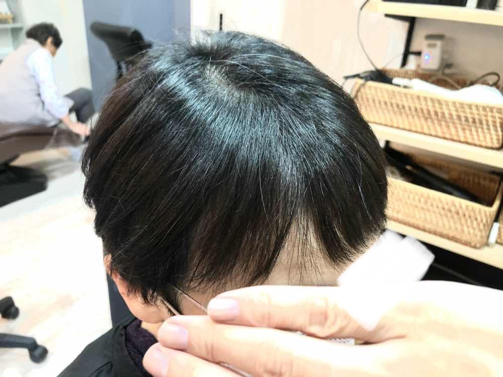 山口市 酸熱トリートメント