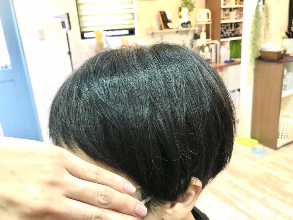 山口市 酸熱トリートメント