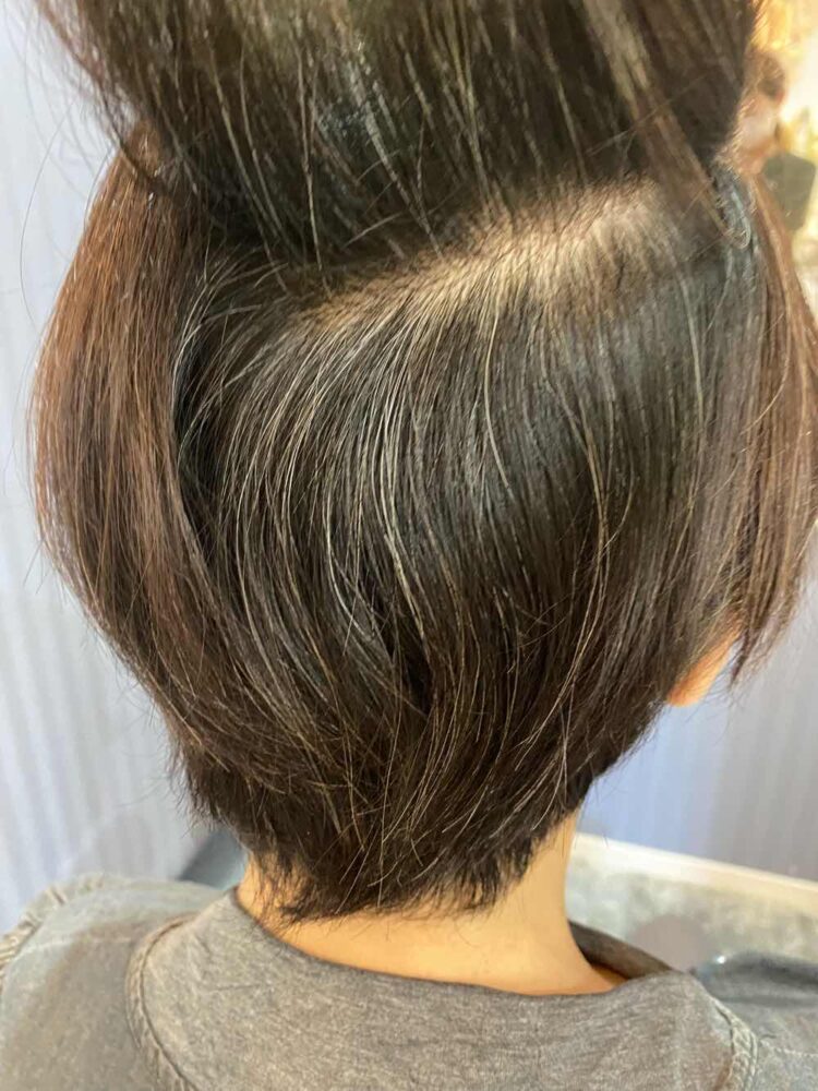 山口市 酸熱トリートメント