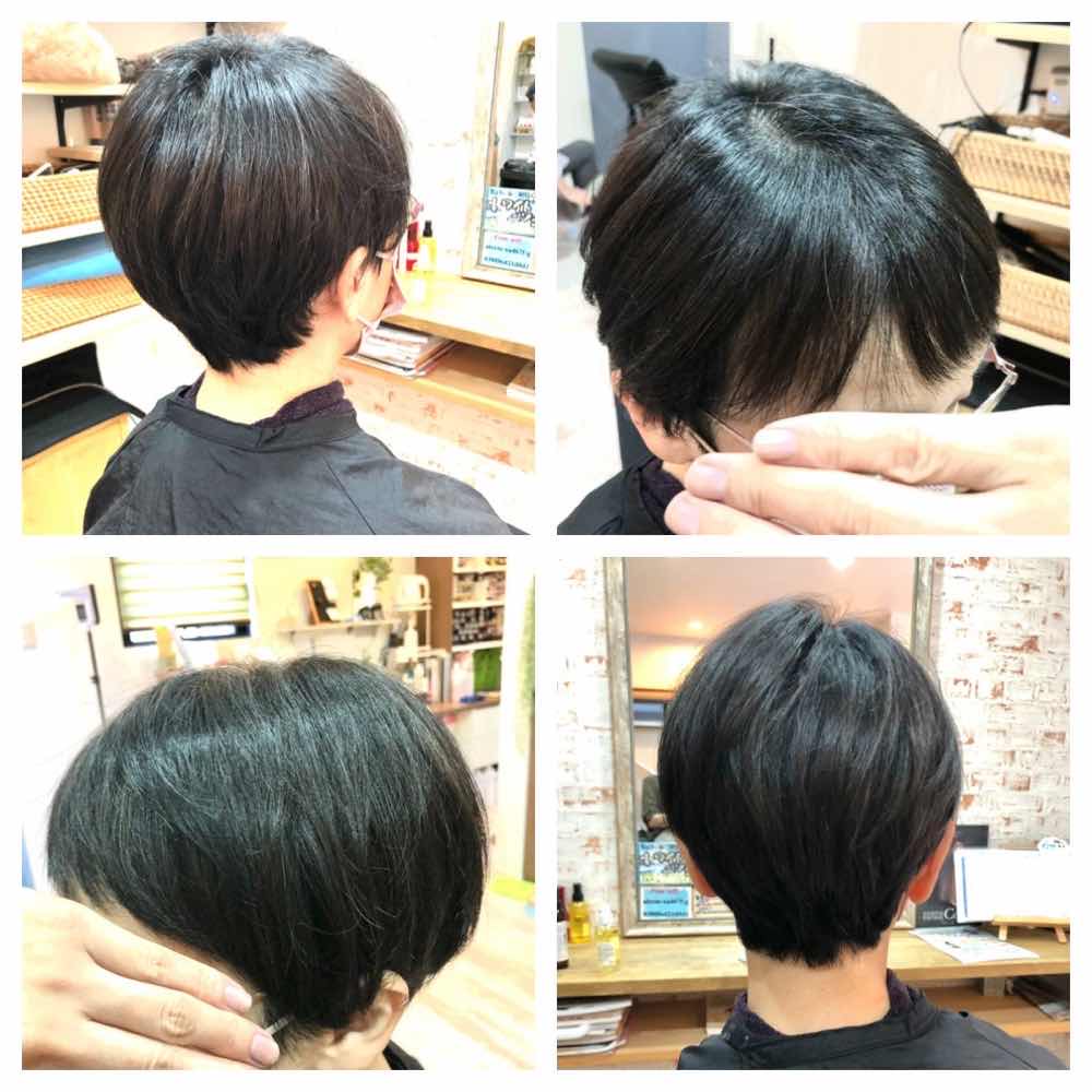 山口市 酸熱トリートメント