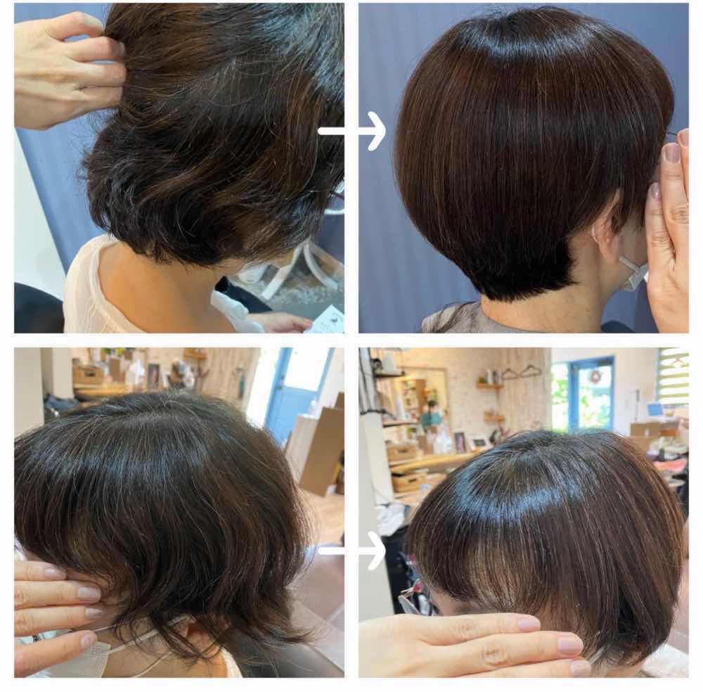 山口市 酸熱トリートメント